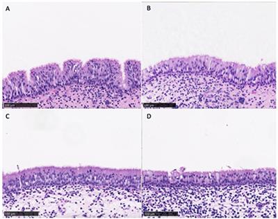 Safety and Efficacy of Topical Chitogel- Deferiprone-Gallium Protoporphyrin in Sheep Model